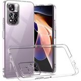 Fibaks Xiaomi Redmi Note 11 Pro Uyumlu Kılıf A+ Şeffaf Lüx Süper Yumuşak 0.3mm Ince Slim Silikon