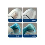 FIXALL ADHESIVE PRODUCTS Spor Ayakkabı Yapışkanlı KEÇE Tamir Yaması Topuk Desteği.16 Adet Set. SİYAH