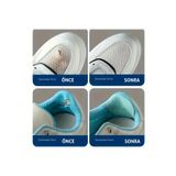 FIXALL ADHESIVE PRODUCTS Spor Ayakkabı Yapışkanlı KEÇE Tamir Yaması Topuk Desteği.16 Adet Set. TEN RENGİ