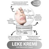 For You Gold Leke Kremi 100 ml Tüm Cilt Tipleri İçin Arbutin ile Leke Karşıtı Etki