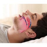 Gees Global Rahat Uyku Için Anti Snore Sleep Horlama Engelleyici Aparat Uyku Stoperi - 1 - Standart