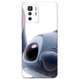 Gramaphone Poco X3 Gt Uyumlu Stitch Desenli Telefon Kılıfı + Ekran Koruyucu - 5946