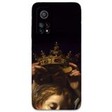 Gramaphone Xiaomi Mi 10T ile Uyumlu Retro Desenli Telefon Kılıfı + Ekran Koruyucu - 5833