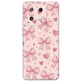 Gramaphone Xiaomi Mi 13 ile Uyumlu Kurdele Desenli Telefon Kılıfı + Ekran Koruyucu - 5802