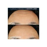 Gultekın RoC Retinol Correxion Smoothing Kırışıklık Karşıtı Kapsül Serum 10 Adet 1247315 20246995836185771247315