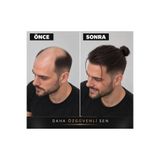 Hairtime ARKADAN BAĞLANABİLİR MODEL – STANDART ÖLÇÜ PROTEZ SAÇ | DOĞAL GÖRÜNÜM