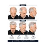 Hairtime Erkek Beyaz Protez Saç – Doğal Görünümlü, Hafif ve Konforlu Saç Sistemi