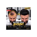 Hairtime LOKAL PROTEZ SAÇ – ÖN BÖLGE İÇİN ÖZEL ALTYAPI | DOĞAL GÖRÜNÜM | KOLAY ŞEKİLLENDİRME