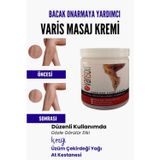 Hbp Avm Var.İs Bölgesi Için Bacak Onarmaya Yardımcı Ve Besleyici Varison Masaj Kremi 200 Ml