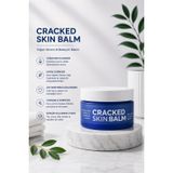HF Healing Formula Çatlak Deri Balsamı, Sea Buckthorn, Tamanu Oil, Calendula ve Jojoba ile, Nemlendirici, 50 ml