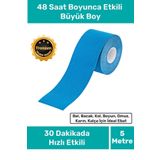 Hızlı Etkili Büyük Boy Kas Eklem Bel Bacak Kol Boyun Sırt Omuz Karın Kalça Ağrı IsıI Bandı 5cm x 5m