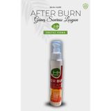 Hk Remedy After Burn Güneş Sonrası Yanık Losyonu 100 Ml