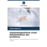 Implantatgestützte orale Rehabilitation des Jochbeins