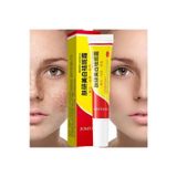 Jomtam Niacinamide İçerikli Çil ve Leke Karşıtı Cilt Bakım Kremi 20 ML