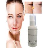 Kentex White Factor Cilt Beyazlatıcı Ton Açıcı Krem 120 ml - Belirtilmemiş