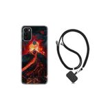 kilifland General Mobile Gm 21 Plus ile Uyumlu Kılıf Ipli Boyun Askılı Desenli Silikon Yanardağ 1611