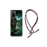 kilifland Oppo A55 ile Uyumlu Kılıf Rasta Ipli Boyun Askılı Desenli Silikon Blue Butterflys 1350