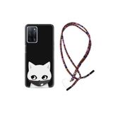 kilifland Oppo A55 ile Uyumlu Kılıf Rasta Ipli Boyun Askılı Desenli Silikon Pandemi Cat 1729