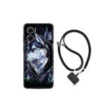 kilifland Xiaomi Redmi Note 11e ile Uyumlu Kılıf Ipli Boyun Askılı Desenli Silikon Dog Eyes 1761
