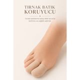 kırmed Nasır Tırnak Batık Koruyucu Kumaş Hortum 1 ADET Silikon Bunyon Ayak Parmak Şapkası