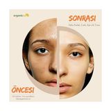 Kojik Asit & Zerdeçal Sabunu 140 gr 1 Adet Leke ve Sivilce Karşıtı Kojic Acid - Kolajen - Aha Bha - C Vitamini - Hyaluronic Acid - Shea Butter Yağı Içerikli Aydınlatıcı Sabun - Option-1