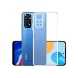 Kvy Xiaomi Redmi Note 11 Pro Kamera Korumalı Süper Silikon Kılıf - Şeffaf