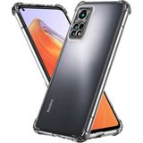 Kzy Xiaomi Redmi Note 11S Global Kapak Kamera Korumalı Şeffaf Airbag Antishock Köşe Korumalı Silikon Kılıf