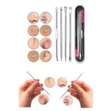 lasting beauty 4 Parça Kutulu Paslanmaz Çelik Sivilce Akne Siyah Nokta Temizleme Komedon Aleti
