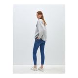 LC Waikiki Lcw Jüpiter Süper Skinny Fit Kadın Jean Pantolon