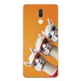 Le Balvo Huawei Mate 10 Lite Uyumlu Lamalar Baskılı Silikon Kılıf