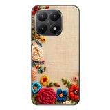 Le Balvo Xiaomi Mi 15T Uyumlu İşlemeli İğne Oyası Baskılı Silikon Kılıf