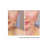 Leke Karşıtı ve Gözenek Sıkılaştırıcı Krem, 200 ml Niacinamide ile