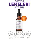 Leke Karşıtı ve Ton Eşitleyici Cilt Bakım Serumu 30 ml