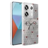 lexroo Xiaomi Redmi Note 13 Pro 4G Kılıf Kamera Korumalı Figürlü Ponti Silikon Kılıf - Açık Mavi T36556