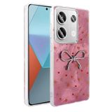 lexroo Xiaomi Redmi Note 13 Pro 4G Kılıf Kamera Korumalı Figürlü Ponti Silikon Kılıf - Açık Pembe T36556