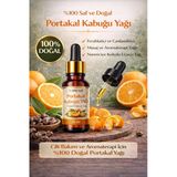 Life Portakal Kabuğu Yağı 20 Ml – %100 Doğal Uçucu Yağ Cilt, Masaj Ve Aromaterapi İçin