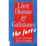 Liver Disease and Gallstones