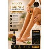 loccis Locci's Karınca Yumurtası Yağı 30 Ml Doğal Yağ– Tüy Azaltıcı, Epilasyon Sonrası Cilt Bakım Yağı