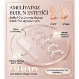 Lovyco Estetik Görünmez Burun Kaldırma Aparatı 3 Farklı Boyut ile Pratik Kullanım ve Konfor