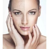Lr Aloe Vera 75 ml Yüz Peelingi