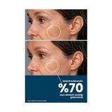 Mabelme Arbutin + Vitamin C Leke Karşıtı Cilt Serumu - Cilt Tonu Eşitleyici, Aydınlatıcı - Option-1