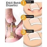 Mabelme Store Batık Tırnak Çıkartıcı Orijinal Çelik Batan Tırnağı Düzeltme Aparatı Düzeltici Aleti Çıkarıcı Aparat