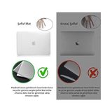MacBook Pro 13 Inç M1 M2 Kılıf A2338 Uyumlu | Mat Sert Koruyucu Kapak Hard Case | A1706 A1708 A1989 A2159 A2251 A2289 Uyumlu Ince Hafif Buzlu Laptop Kılıfı Bordo - 1 GB - 00-Siyah - Beyaz - Option-1