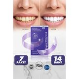 Magical White V34 Mor Diş Beyazlatma Bandı - Sarılık Karşıtı Renk Düzeltici Diş Beyazlatıcı Şerit Seti (7 Paket/14 Adet)