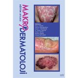Makro Dermatoloji Eğitim Atlası - Nobel Tıp Kitabevleri