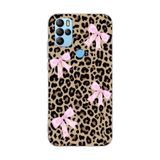 Manitoba General Mobile GM 21 Pro Uyumlu Leopar Desenli Fiyonk Baskılı Şeffaf Silikon Telefon Kılıfı