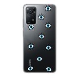 Manitoba Xiaomi Redmi Note 11 Pro/Note 12 Pro 4G ile Uyumlu Baskılı Yumuşak Silikon Şeffaf Telefon Kılıfı, Mavi Göz Deseni