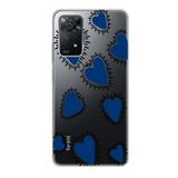 Manitoba Xiaomi Redmi Note 11 Pro/Note 12 Pro 4G ile Uyumlu Baskılı Yumuşak Silikon Şeffaf Telefon Kılıfı, Mavi Kalp Deseni