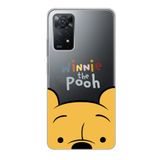 Manitoba Xiaomi Redmi Note 11 Pro/Note 12 Pro 4G ile Uyumlu Baskılı Yumuşak Silikon Şeffaf Telefon Kılıfı, Sarı