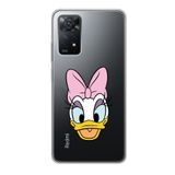 Manitoba Xiaomi Redmi Note 11 Pro/Note 12 Pro 4G ile Uyumlu Daphne Tasarımlı Baskılı Şeffaf Telefon Kılıfı